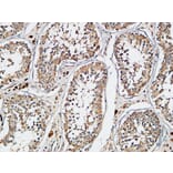 Immunohistochemistry - Anti-XIAP Antibody (B0599) - Antibodies.com