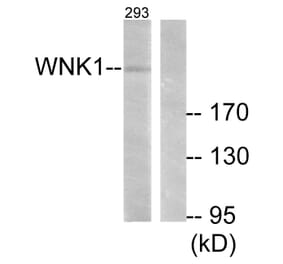 Western Blot - Anti-WNK1 Antibody (B0093) - Antibodies.com