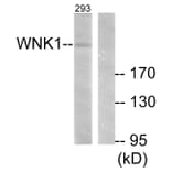 Western Blot - Anti-WNK1 Antibody (B0093) - Antibodies.com