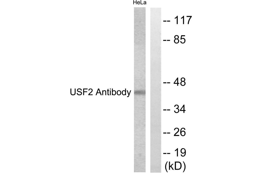 Western Blot - Anti-USF2 Antibody (C0387) - Antibodies.com