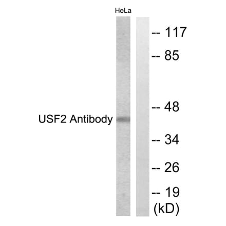 Western Blot - Anti-USF2 Antibody (C0387) - Antibodies.com