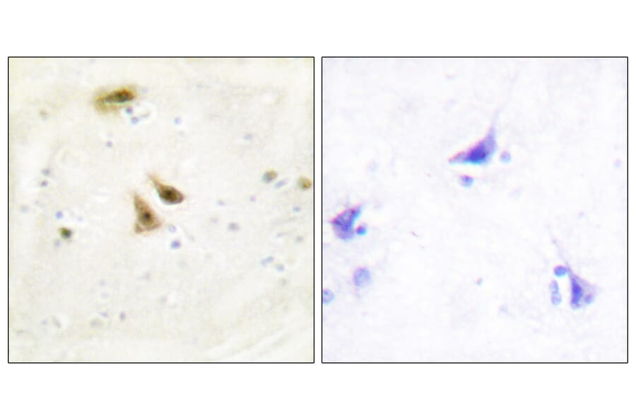 Immunohistochemistry - Anti-UBF1 Antibody (C10403) - Antibodies.com