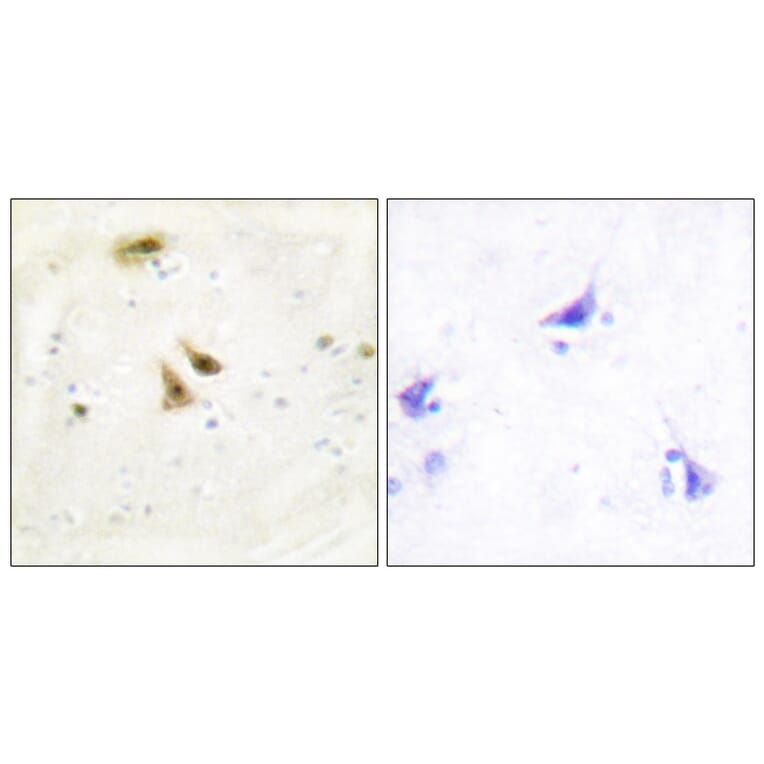 Immunohistochemistry - Anti-UBF1 Antibody (C10403) - Antibodies.com