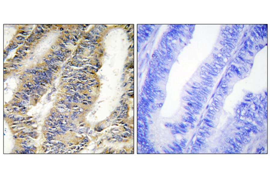 Immunohistochemistry - Anti-TNFA Antibody (C10265) - Antibodies.com