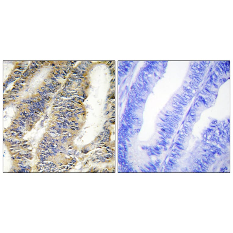 Immunohistochemistry - Anti-TNFA Antibody (C10265) - Antibodies.com