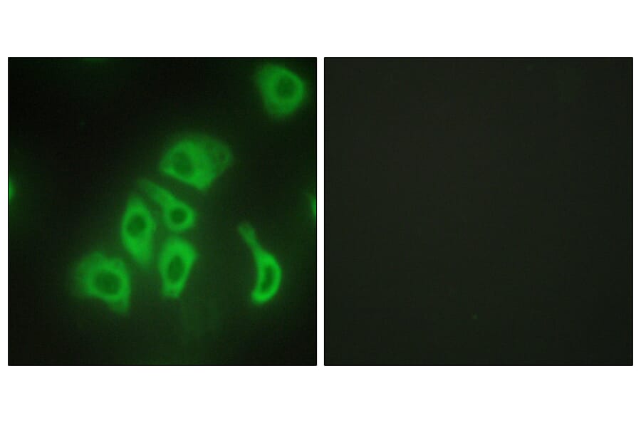 Immunofluorescence - Anti-TNFA Antibody (C10265) - Antibodies.com