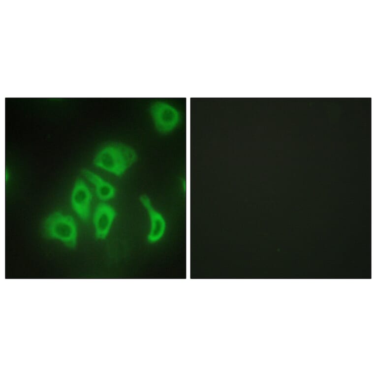 Immunofluorescence - Anti-TNFA Antibody (C10265) - Antibodies.com