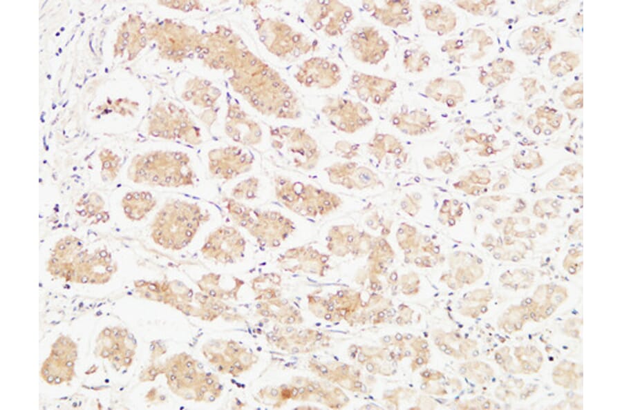 Immunohistochemistry - Anti-TNFA Antibody (C10265) - Antibodies.com