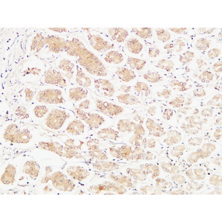 Immunohistochemistry - Anti-TNFA Antibody (C10265) - Antibodies.com