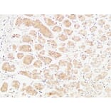 Immunohistochemistry - Anti-TNFA Antibody (C10265) - Antibodies.com