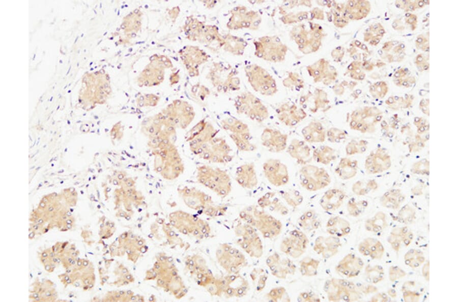 Immunohistochemistry - Anti-TNFA Antibody (C10265) - Antibodies.com