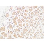 Immunohistochemistry - Anti-TNFA Antibody (C10265) - Antibodies.com