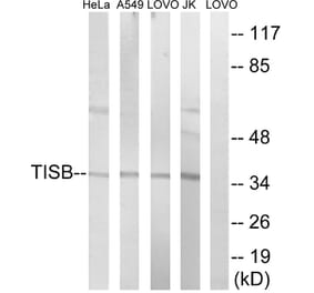 Western Blot - Anti-TISB Antibody (B1184) - Antibodies.com