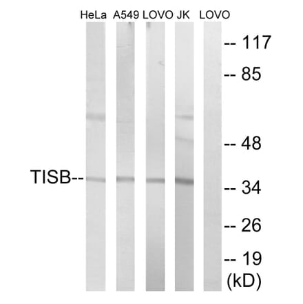 Western Blot - Anti-TISB Antibody (B1184) - Antibodies.com