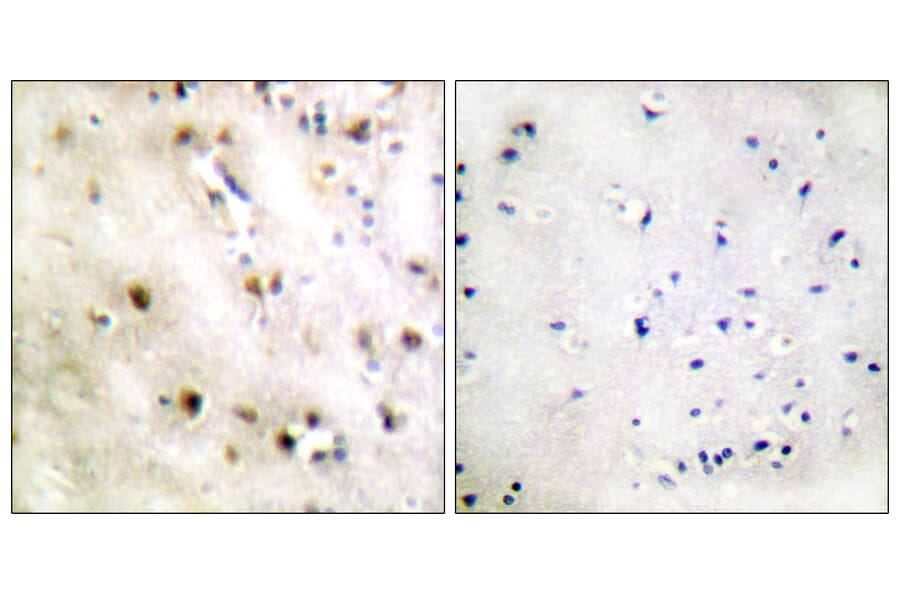 Immunohistochemistry - Anti-TISB Antibody (B1184) - Antibodies.com