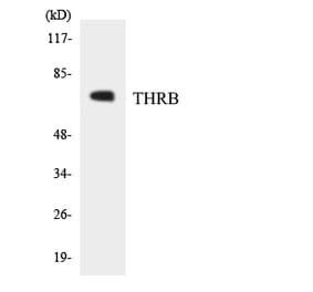 Western Blot - Anti-THRB Antibody (R12-3623) - Antibodies.com
