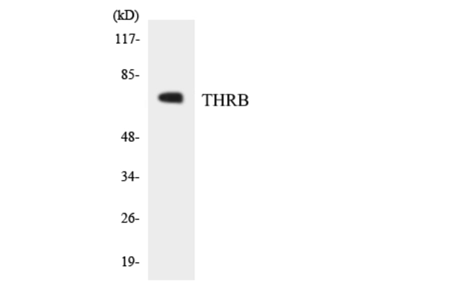 Western Blot - Anti-THRB Antibody (R12-3623) - Antibodies.com