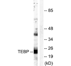 Western Blot - Anti-TEBP Antibody (B0583) - Antibodies.com