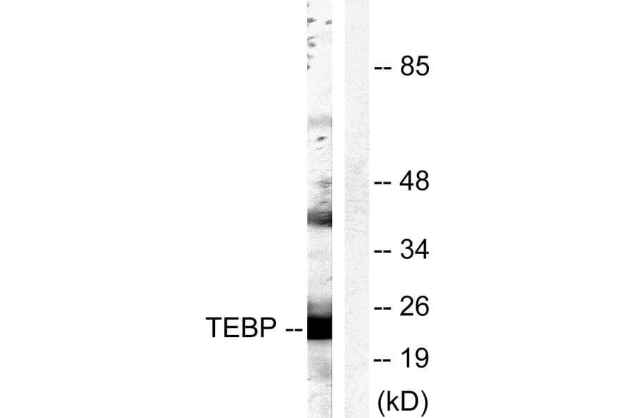 Western Blot - Anti-TEBP Antibody (B0583) - Antibodies.com
