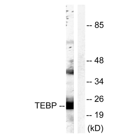 Western Blot - Anti-TEBP Antibody (B0583) - Antibodies.com
