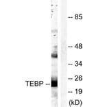 Western Blot - Anti-TEBP Antibody (B0583) - Antibodies.com