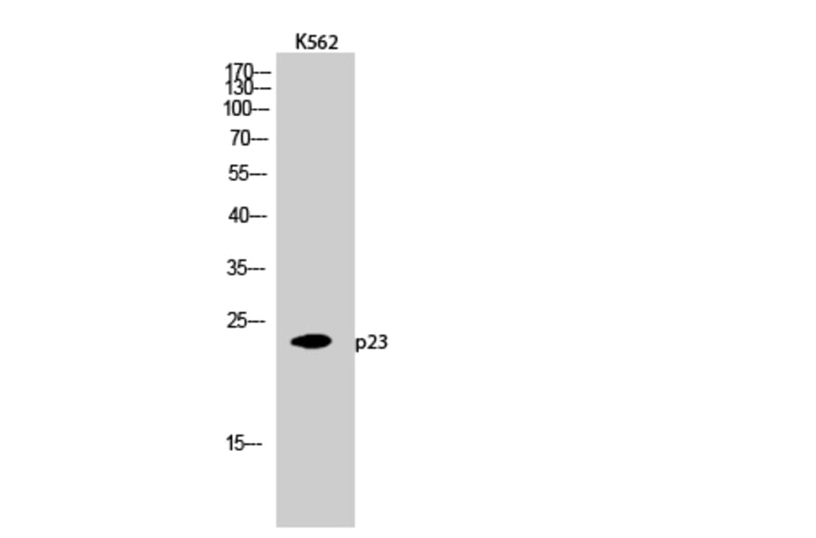Western Blot - Anti-TEBP Antibody (B0583) - Antibodies.com