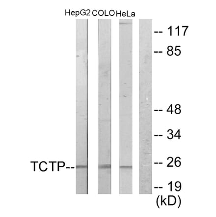 Western Blot - Anti-TCTP Antibody (C10362) - Antibodies.com