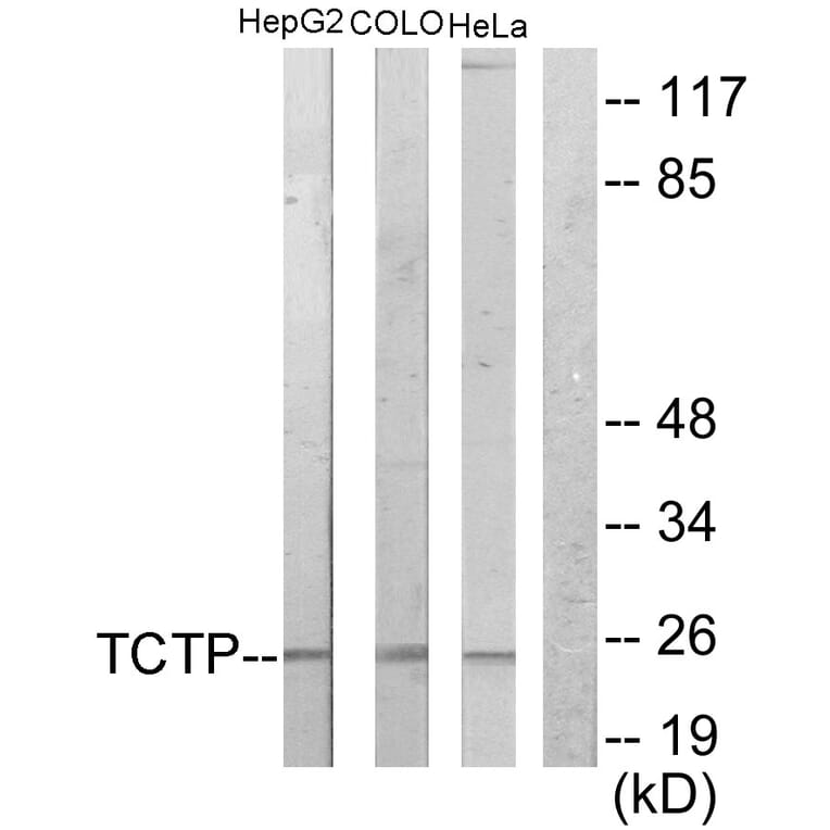 Western Blot - Anti-TCTP Antibody (C10362) - Antibodies.com