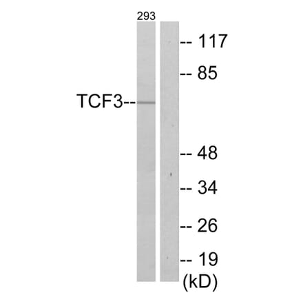 Western Blot - Anti-TCF3 Antibody (C10385) - Antibodies.com
