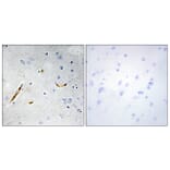 Immunohistochemistry - Anti-TCF3 Antibody (C10385) - Antibodies.com