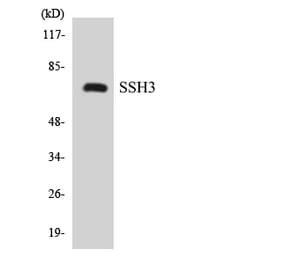 Western Blot - Anti-SSH3 Antibody (R12-3563) - Antibodies.com