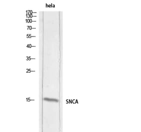 Western Blot - Anti-SNCA Antibody (C30743) - Antibodies.com