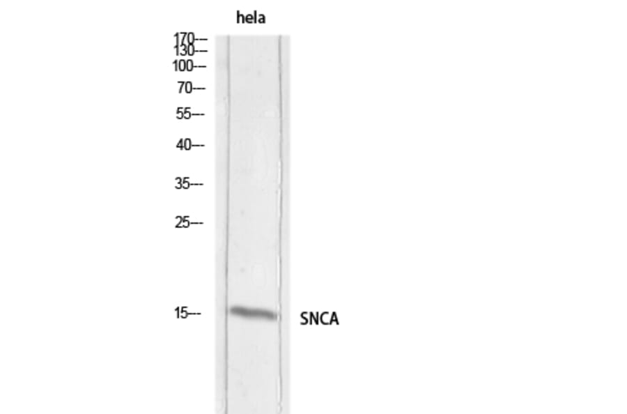 Western Blot - Anti-SNCA Antibody (C30743) - Antibodies.com