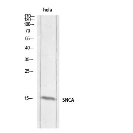 Western Blot - Anti-SNCA Antibody (C30743) - Antibodies.com