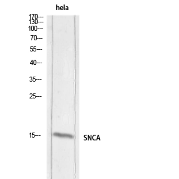 Western Blot - Anti-SNCA Antibody (C30743) - Antibodies.com