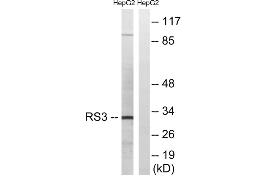 Western Blot - Anti-RPS3 Antibody (C14118) - Antibodies.com