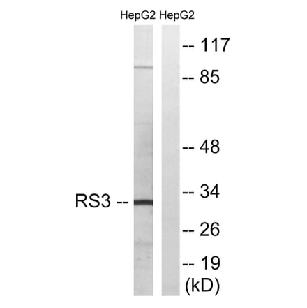 Western Blot - Anti-RPS3 Antibody (C14118) - Antibodies.com