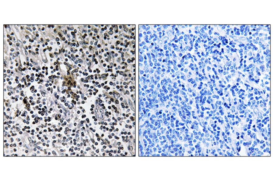Immunohistochemistry - Anti-RPS3 Antibody (C14118) - Antibodies.com