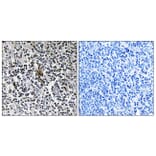 Immunohistochemistry - Anti-RPS3 Antibody (C14118) - Antibodies.com