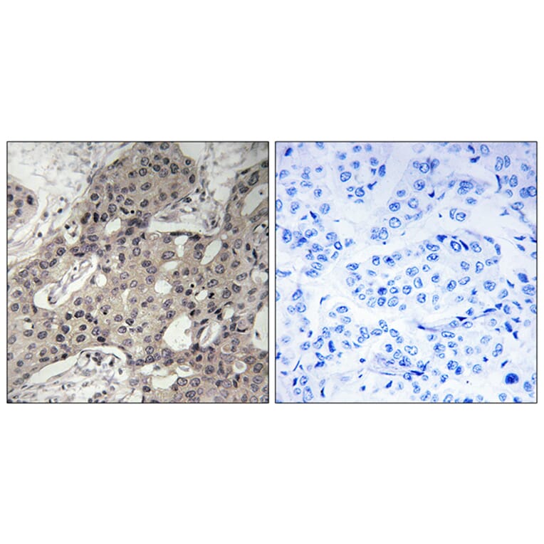 Immunohistochemistry - Anti-RPL3 Antibody (C14168) - Antibodies.com