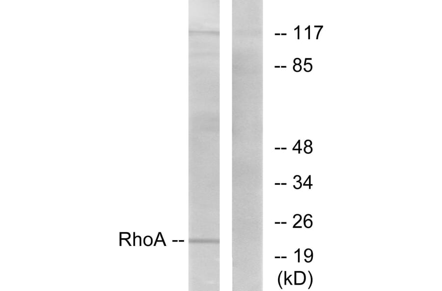 Western Blot - Anti-RhoA Antibody (B0568) - Antibodies.com