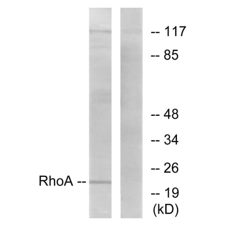 Western Blot - Anti-RhoA Antibody (B0568) - Antibodies.com