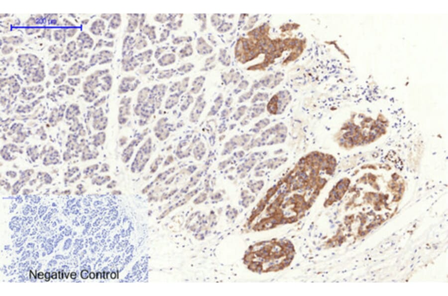 Immunohistochemistry - Anti-RhoA Antibody (B0568) - Antibodies.com