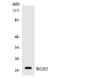 Western Blot - Anti-RGS5 Antibody (R12-3435) - Antibodies.com