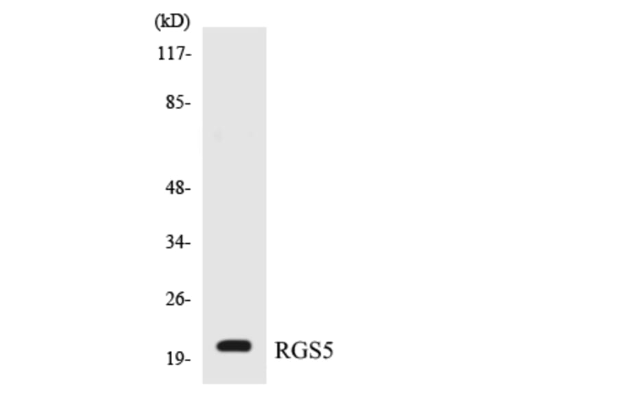 Western Blot - Anti-RGS5 Antibody (R12-3435) - Antibodies.com