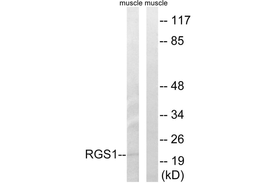 Western Blot - Anti-RGS1 Antibody (C18308) - Antibodies.com