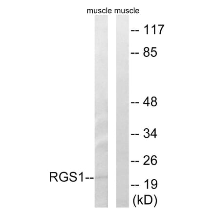 Western Blot - Anti-RGS1 Antibody (C18308) - Antibodies.com