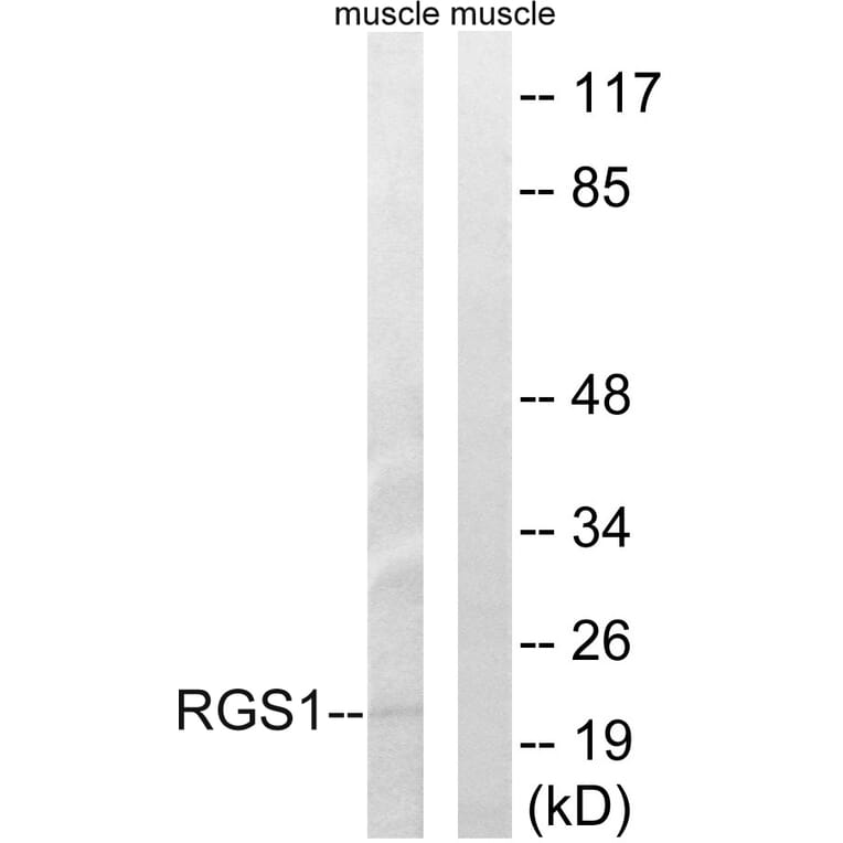 Western Blot - Anti-RGS1 Antibody (C18308) - Antibodies.com