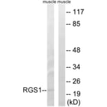 Western Blot - Anti-RGS1 Antibody (C18308) - Antibodies.com