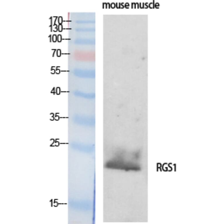 Western Blot - Anti-RGS1 Antibody (C18308) - Antibodies.com